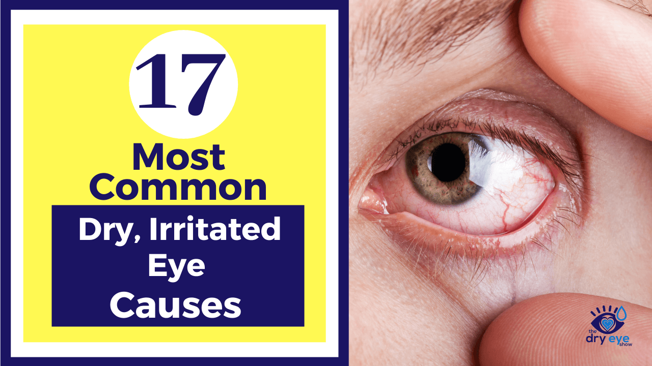 17 Most Common Dry, Irritated Eye Causes | Rethinking Dry Eye Treatment Book