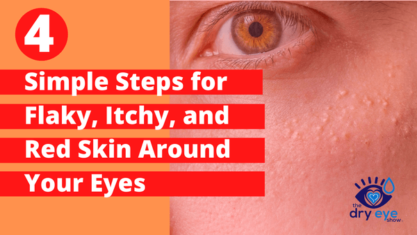 4 Simple Steps for Flaky, Itchy, and Red Skin Around Your Eyes