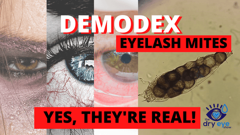 Demodex Eyelash Mites...Yes, They're Real!