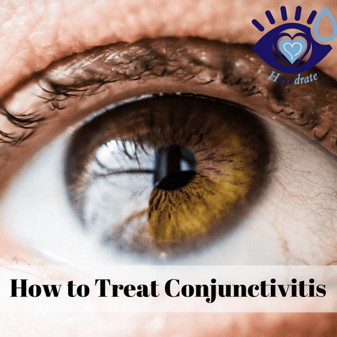 How to Treat Conjunctivitis
