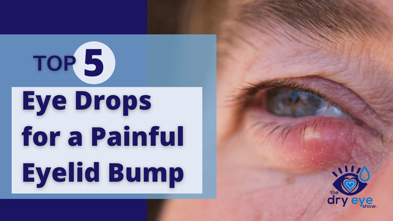 Top 5 Eye Drops for a Painful Eyelid Bump
