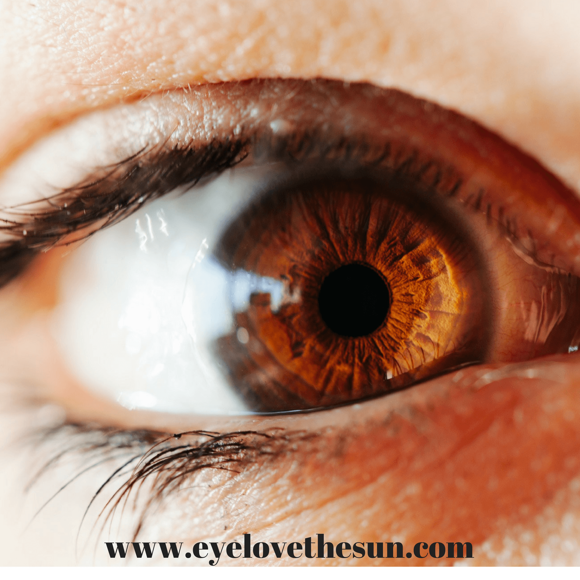 How Do You Treat Severe Dry Eye?
