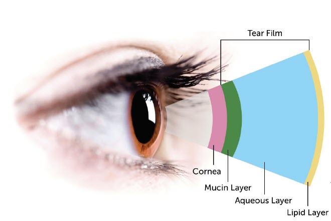 NuLids by NuSight Medical | Purchase Here - Eye Love